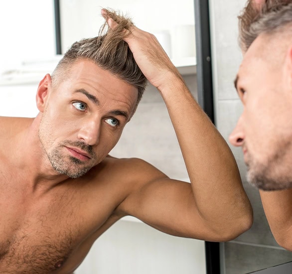 Transplantace vlasů muži